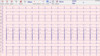 small.img.alt