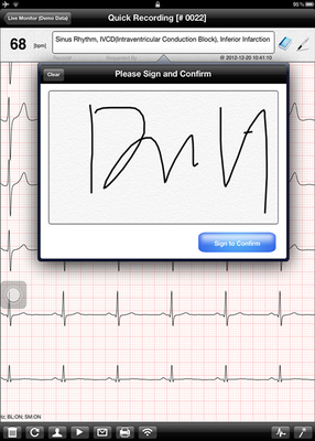 Multichannel Home ECG Machine