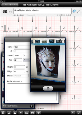 Wireless Home ECG Machine
