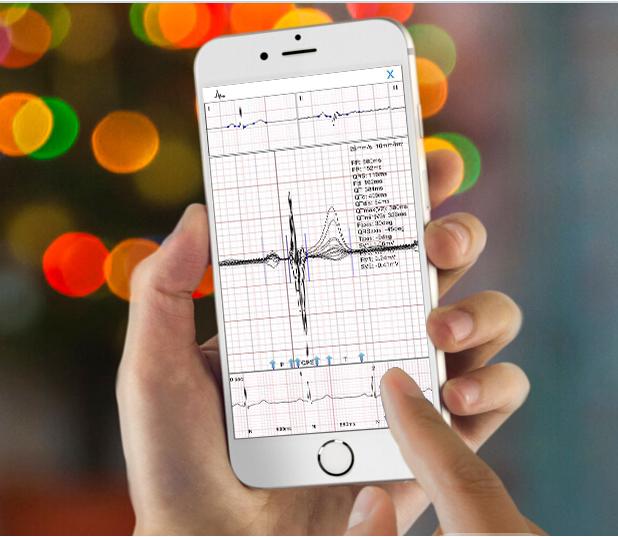 Iphone Resting Ecg Mobile Device Wireless Bluetooth Transfer With White ...
